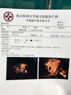 胎儿彩超价格(二维彩超多少钱一次的啊?准备过两天去医院产检的) 第2张 胎儿彩超价格(二维彩超多少钱一次的啊?准备过两天去医院产检的) 第2张