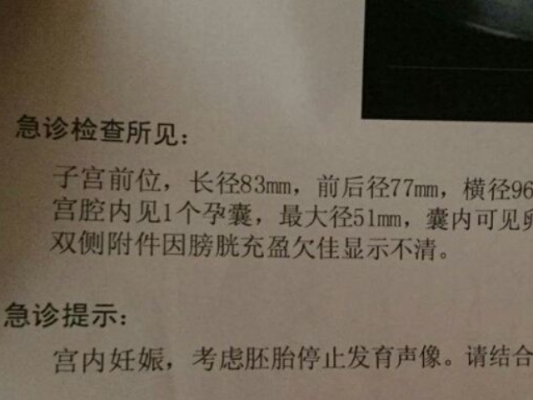 胎儿停育原因(胚胎停育是什么意思?什么原因会导致胚胎停) 第2张 胎儿停育原因(胚胎停育是什么意思?什么原因会导致胚胎停) 第2张