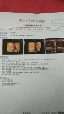 胎儿三围（做三维宝宝不动怎么办？我是下午去做检查，是否有问题呢）  第2张
