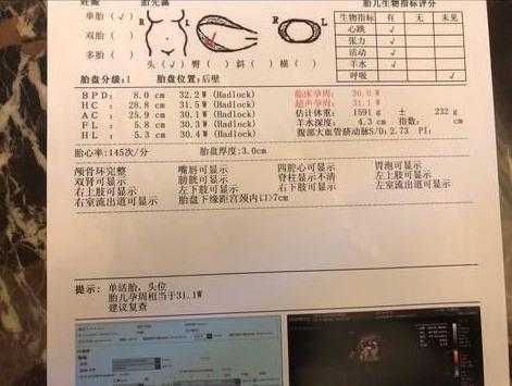 胎儿偏大原因(胎儿偏大原因造成的) 第1张 胎儿偏大原因(胎儿偏大原因造成的) 第1张