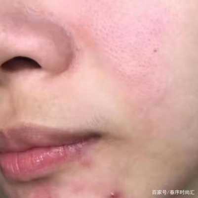 孕期不护肤(孕期不护肤有什么危害) 第1张 孕期不护肤(孕期不护肤有什么危害) 第1张
