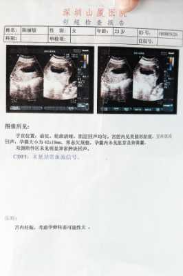 怀孕83天是几周和几个月啊,怀孕83天 第3张 怀孕83天是几周和几个月啊,怀孕83天 第3张