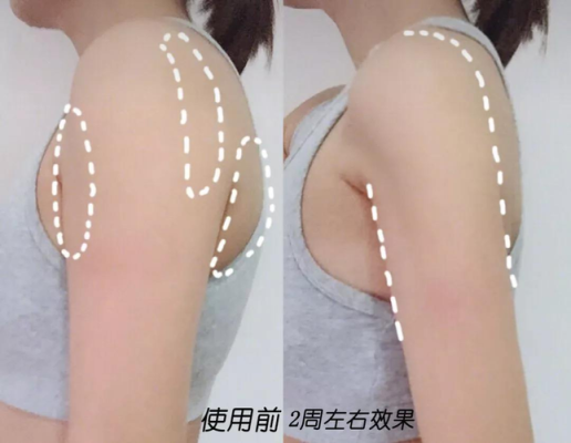 孕期胳膊粗(孕期胳膊粗怎么减肥) 第1张 孕期胳膊粗(孕期胳膊粗怎么减肥) 第1张