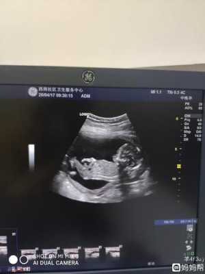 怀孕16周胎儿稳定了吗(怀孕16周胎儿稳定了吗正常吗) 第1张 怀孕16周胎儿稳定了吗(怀孕16周胎儿稳定了吗正常吗) 第1张