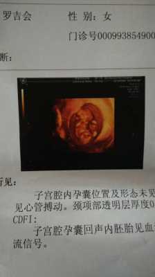 105天的宝宝视力能看多远,105天的胎儿有多大图解  第3张