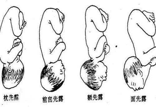 胎儿先露头是什么意思（胎儿先露头是什么意思）  第1张