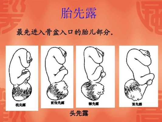 胎儿先露头是什么意思（胎儿先露头是什么意思）  第2张