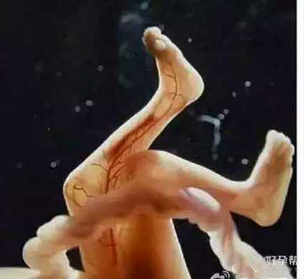 9个月肚子里宝宝老动,孕9个月胎儿图片 第2张 9个月肚子里宝宝老动,孕9个月胎儿图片 第2张