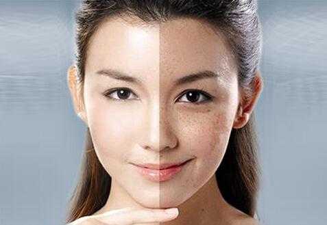 孕期防止长斑(为什么脸上有斑要防晒) 第1张 孕期防止长斑(为什么脸上有斑要防晒) 第1张
