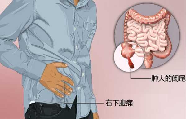 怀孕两个月右侧小腹疼痛怎么回事,孕期右下腹疼痛的原因 第1张 怀孕两个月右侧小腹疼痛怎么回事,孕期右下腹疼痛的原因 第1张