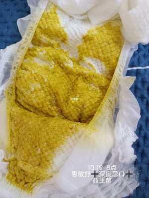 孕期便便多(孕期便便多是怎么回事) 第2张 孕期便便多(孕期便便多是怎么回事) 第2张