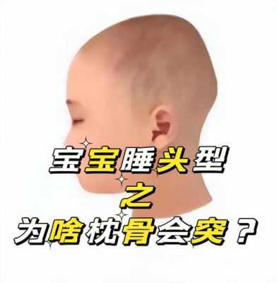 胎儿头臀高是什么意思(枕骨高的宝宝怎么抱) 第2张 胎儿头臀高是什么意思(枕骨高的宝宝怎么抱) 第2张