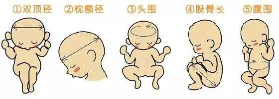 胎儿头臀高是什么意思(枕骨高的宝宝怎么抱) 第1张 胎儿头臀高是什么意思(枕骨高的宝宝怎么抱) 第1张