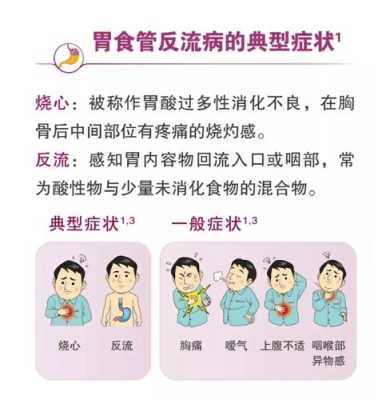 胃食管反流的原因,胃食管反流是怎么回事,孕期食道反流怎么缓解 第2张 胃食管反流的原因,胃食管反流是怎么回事,孕期食道反流怎么缓解 第2张