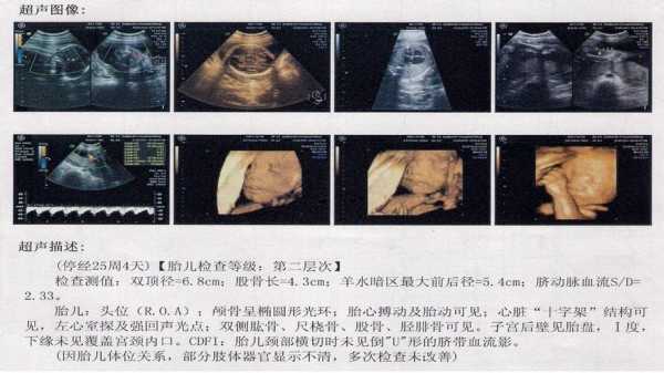怀孕7个月可以做四维彩超吗,胎儿七个月四维彩超图 第2张 怀孕7个月可以做四维彩超吗,胎儿七个月四维彩超图 第2张