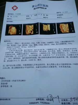 四维图新是什么导航,孕期四维图片 第1张 四维图新是什么导航,孕期四维图片 第1张