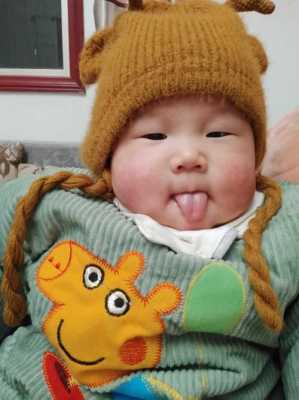 胎儿伸舌头（婴儿经常吐舌头是怎么回事）  第1张