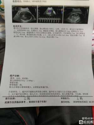 医生说可能胎儿右肾会偏小,应该怎么办,胎儿肾变小了是不是萎缩了 第2张 医生说可能胎儿右肾会偏小,应该怎么办,胎儿肾变小了是不是萎缩了 第2张