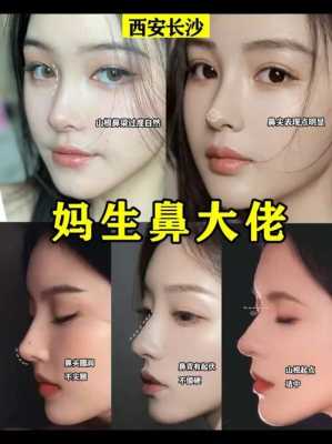 婴儿鼻型如何判断鼻梁高,胎儿鼻子高是男孩女孩 第3张 婴儿鼻型如何判断鼻梁高,胎儿鼻子高是男孩女孩 第3张