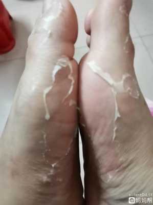 孕妇脚底脱皮是怎么回事呢,孕期皮肤干燥起皮屑怎么办 第1张 孕妇脚底脱皮是怎么回事呢,孕期皮肤干燥起皮屑怎么办 第1张