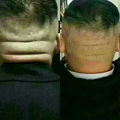 胎儿后脑增宽(胎儿后脑增宽的原因是什么) 第2张 胎儿后脑增宽(胎儿后脑增宽的原因是什么) 第2张