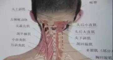 胎儿后脑增宽(胎儿后脑增宽的原因是什么) 第1张 胎儿后脑增宽(胎儿后脑增宽的原因是什么) 第1张