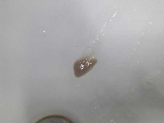 孕期咳嗽有黄痰(孕37周喉咙痛有黄痰,会感染胎儿吗) 第3张 孕期咳嗽有黄痰(孕37周喉咙痛有黄痰,会感染胎儿吗) 第3张
