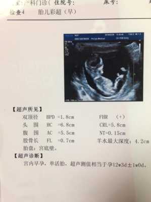 产检胎儿头大（产检胎儿头大是什么原因）  第2张