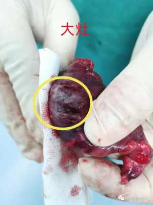 胎儿错构瘤(胎儿错构瘤严重吗) 第1张 胎儿错构瘤(胎儿错构瘤严重吗) 第1张