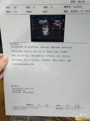 早孕检查可见原始心管搏动，这是什么意思啊,产检胎儿心脏彩超有必要吗  第2张