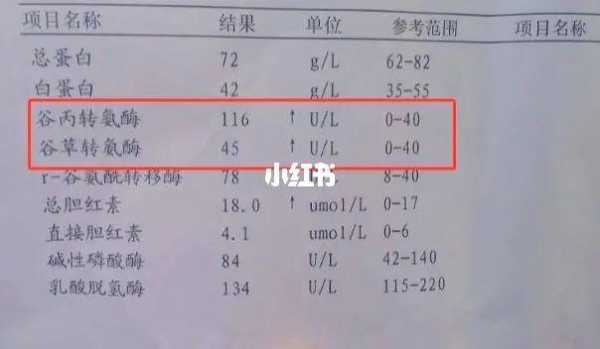孕妇肝功能检查谷丙转氨酶偏高严重吗,孕期谷草谷丙偏高什么原因 第2张 孕妇肝功能检查谷丙转氨酶偏高严重吗,孕期谷草谷丙偏高什么原因 第2张
