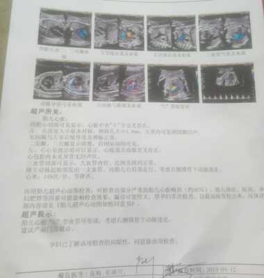 胎儿右心偏大(胎儿右心偏大一般会是什么问题) 第2张 胎儿右心偏大(胎儿右心偏大一般会是什么问题) 第2张