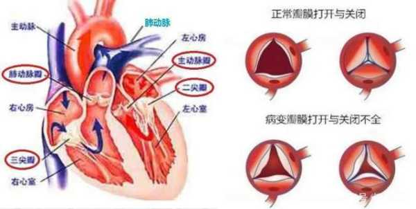 胎儿心脏返流（胎儿心脏返流是怎么回事）  第1张
