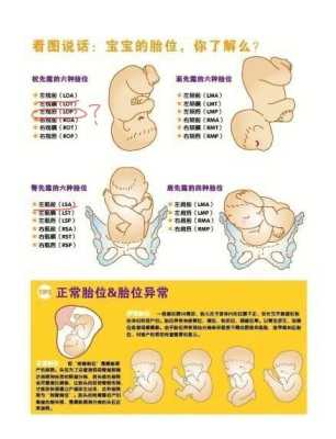 32周头位,后期还会变动吗,32周胎儿头位是什么意思 第3张 32周头位,后期还会变动吗,32周胎儿头位是什么意思 第3张