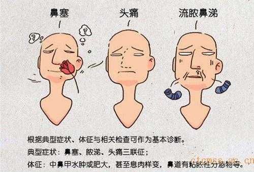 怀孕鼻炎犯了影响胎儿(怀孕鼻炎犯了影响胎儿吗) 第1张 怀孕鼻炎犯了影响胎儿(怀孕鼻炎犯了影响胎儿吗) 第1张