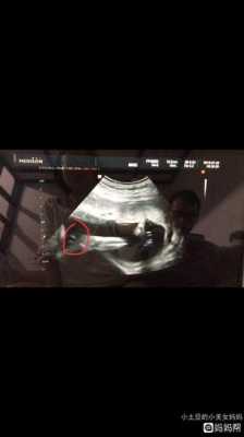 四隅四正四维的区别,四维胎儿正面照看男女 第3张 四隅四正四维的区别,四维胎儿正面照看男女 第3张