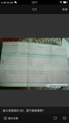 缺氧会导致胎儿什么结果(怎样判断胎儿是否缺氧) 第1张 缺氧会导致胎儿什么结果(怎样判断胎儿是否缺氧) 第1张