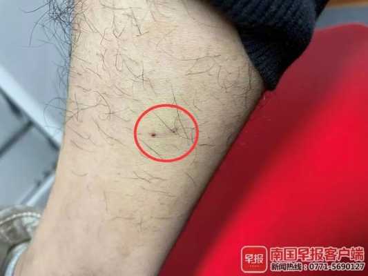 怀孕期间被狗咬了(怀孕期间狗咬了对宝宝有影响吗) 第1张 怀孕期间被狗咬了(怀孕期间狗咬了对宝宝有影响吗) 第1张