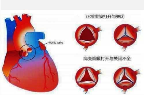 胎儿心脏三尖瓣反流(胎儿心脏三尖瓣反流是什么意思) 第2张 胎儿心脏三尖瓣反流(胎儿心脏三尖瓣反流是什么意思) 第2张