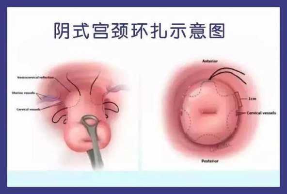怀孕几个月胎儿开始长头发(北方小孩后脑勺留长头发有什么说法) 第3张 怀孕几个月胎儿开始长头发(北方小孩后脑勺留长头发有什么说法) 第3张