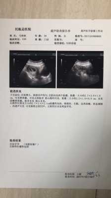 胎心弱对胎儿有影响吗(孕早期胎心弱怎么办?要去医院检查吗) 第2张 胎心弱对胎儿有影响吗(孕早期胎心弱怎么办?要去医院检查吗) 第2张