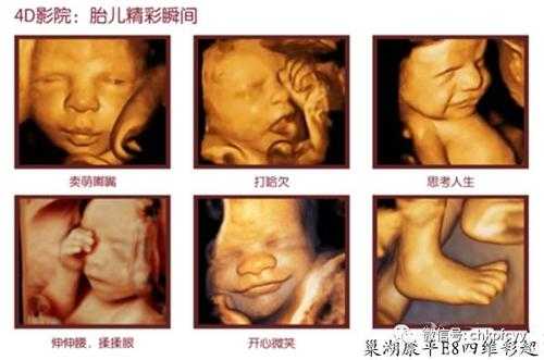 四维彩超对胎儿的影响(四维不过关是什么原因啊?刚做的检查了,这样胎儿会发育不好吗) 第2张 四维彩超对胎儿的影响(四维不过关是什么原因啊?刚做的检查了,这样胎儿会发育不好吗) 第2张