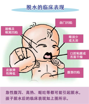 胎儿脱水(胎儿脱水什么意思) 第1张 胎儿脱水(胎儿脱水什么意思) 第1张