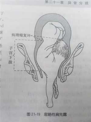 胎儿前肩(胎儿前肩是哪个部位) 第3张 胎儿前肩(胎儿前肩是哪个部位) 第3张