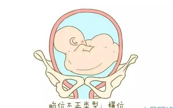胎儿前肩(胎儿前肩是哪个部位) 第1张 胎儿前肩(胎儿前肩是哪个部位) 第1张