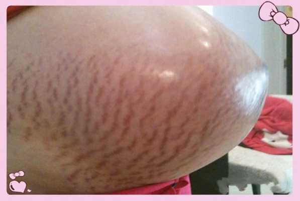 悬浮肚胎儿(悬浮肚胎儿在肚子里什么样子) 第2张 悬浮肚胎儿(悬浮肚胎儿在肚子里什么样子) 第2张