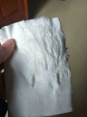 孕期流粘液(孕妇流粘液) 第3张 孕期流粘液(孕妇流粘液) 第3张