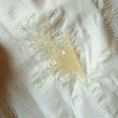 孕期流粘液(孕妇流粘液) 第2张 孕期流粘液(孕妇流粘液) 第2张