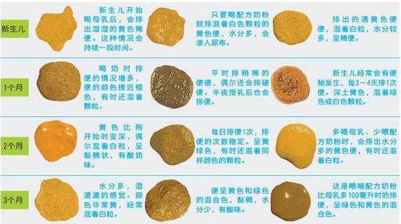 孕期屎很多(孕期屎很多怎么回事) 第2张 孕期屎很多(孕期屎很多怎么回事) 第2张