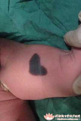 婴儿后背青怎么回事,胎儿身上青色的胎记是怎么回事 第2张 婴儿后背青怎么回事,胎儿身上青色的胎记是怎么回事 第2张